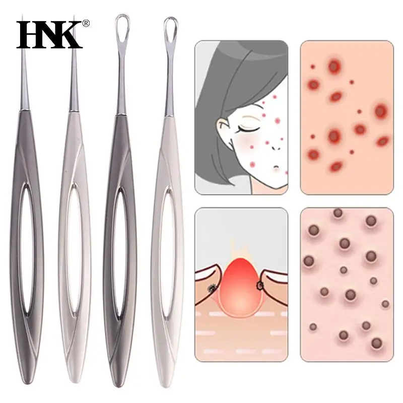 Acne Needle Blackhead Clip Remover Extraction Popper Pore Black Head