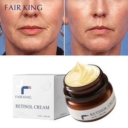 Fairking retinol anti-envelhecimento creme facial reduz rugas e suaviza a pele áspera rosto cuidados com a pele aumentar a elasticidade da pele 30g