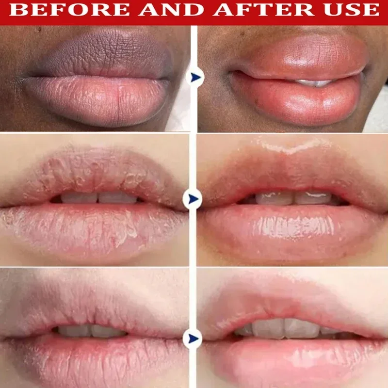 Remove Dark Lip Balm Lightening Melanin Mask Gloss Oil Exfoliating Clean Moisturizer Korean Care Products Makeup Beauty Health 2