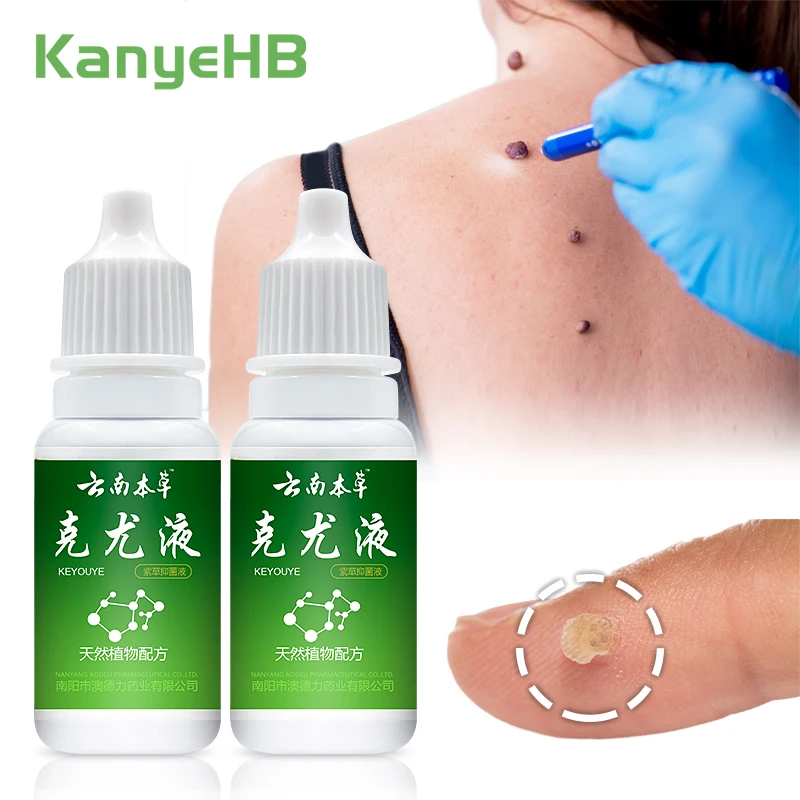 

2 шт., жидкий экстракт бородавок, бородавок