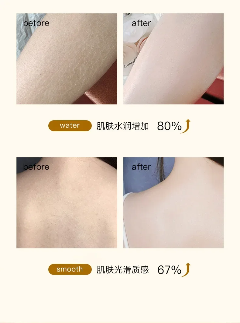300ml Sulfur mite removing soap, shower gel, cleansing and beauty body lotion fragrance,Body Cleansers Bath & Shower