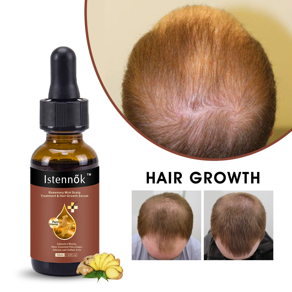 Professional Natural Ginger Anti Hair Loss Essential Oils Hair Care Growth Serum For Women Men Beauty Health Organic Products aravia professional сплэш сыворотка для лица лифтинг эффект intesive care revita serum