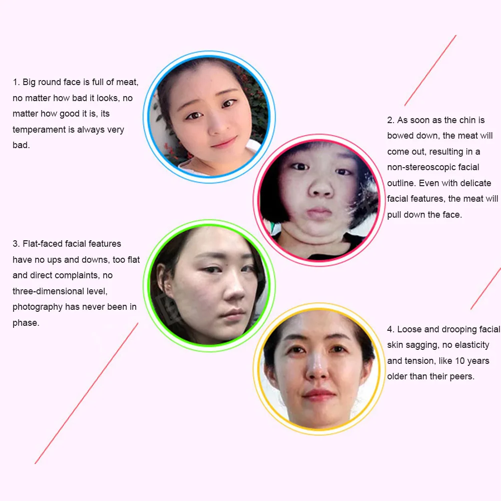 Women Face Lifting Slim Mask Facial Chin Cheek Myoedema of Lean Infants With Double Chins V Shaper Slimming Lift Up Bandage