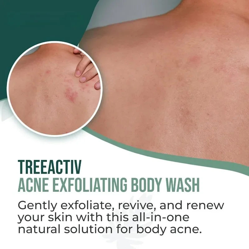 EHD Salicylic Acid Fragrance Body Wash Gentle Exfoliating for Blemish-Prone Skin Oil Control pH Balance Shower Gel Smooth Skin