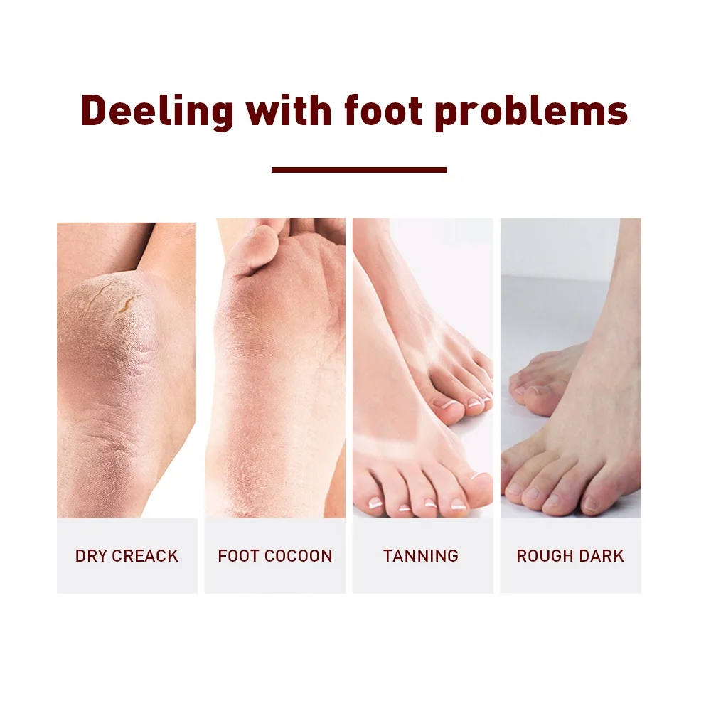 Exfoliating Feet Mask Exfoliating Foot Peel Mask Socks Pedicure Peeling Dead Skin Remover Feet Peel Moisturizing 1 Pair foot peel mask