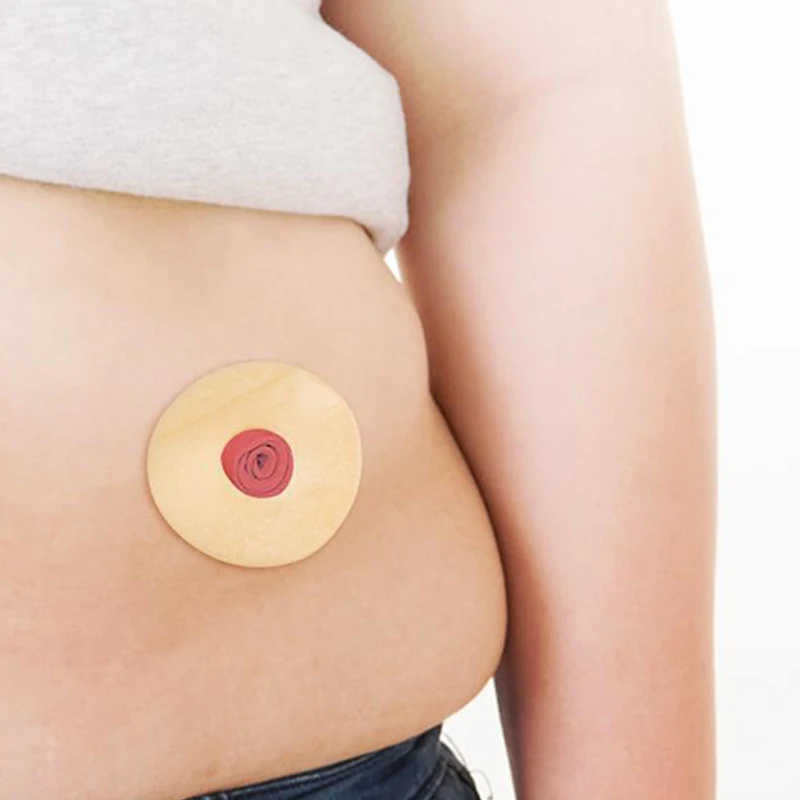 Anti-Leakage Ring 10Pcs For Colostomy Bag Ostomy Paste Ring Baseplates Stoma Care Products To Protect Skin
