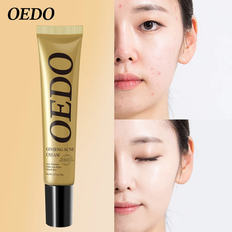 OEDO Ginseng Scutellariae Extract Face Care Ance Treatment Skin Care Facial Cream Plant Extraction Repair Acne Cream Whitening
