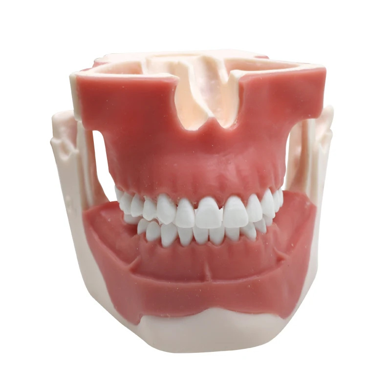 

Dental Implant Teeth Model Upper Lower Jaw Model Dentist Student Learning Practice Model Dental Materials