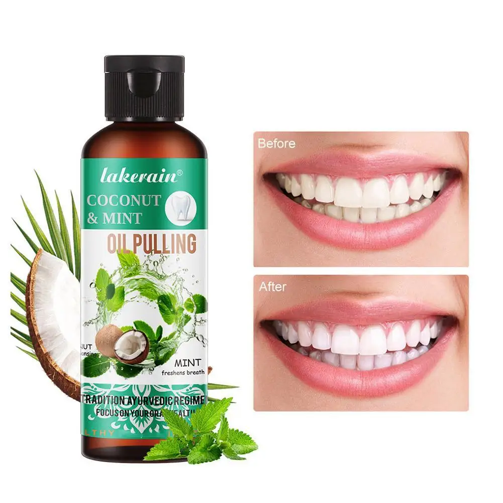 

Coconut Mint Pulling Oil Mouthwash Cleaning Mouth Hygiene Fresh Breath Whitening Teeth Protect Gums Oral Health Care
