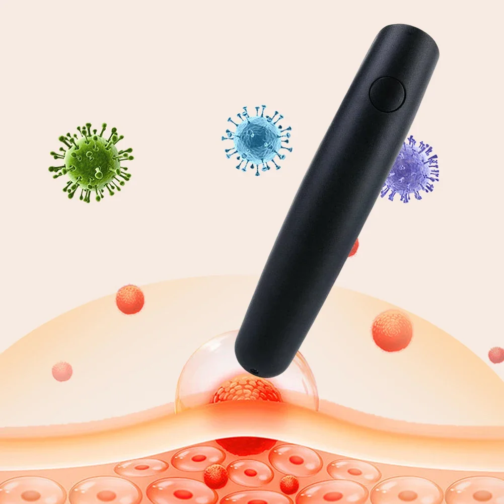 Insect Bite Healer Electronic Mosquito Bite Relief Stick Electronic Mosquito Bite Pen for Itching Bite Insect Mosquito Relieve