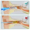Ear Cleaner Irrigation Kit Ear Wax Removal Tool Water Washing Syringe Comfortable Unique 12/20ML Health Care 5