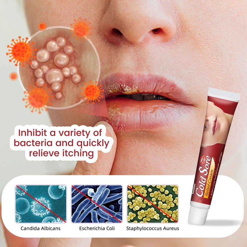 

20g Cold Sores Lip Care Cream Repair Cheilitis Lips Herpes Ulceration Antibacterial Ointment Moisturizing Lip Balm