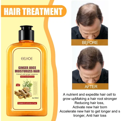 100ml 생강 샴푸 탈모 대머리 및 비듬 보습, 모발 관리 두꺼운 성장 에센스 재성장 두꺼운 3