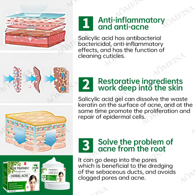 Pattanó Krém Gyógynövény-Esszencia Gyulladásgátló, Anti-Acne, Olajkontroll, Mindenféle Pattanáshoz Alkalmas - Image 6