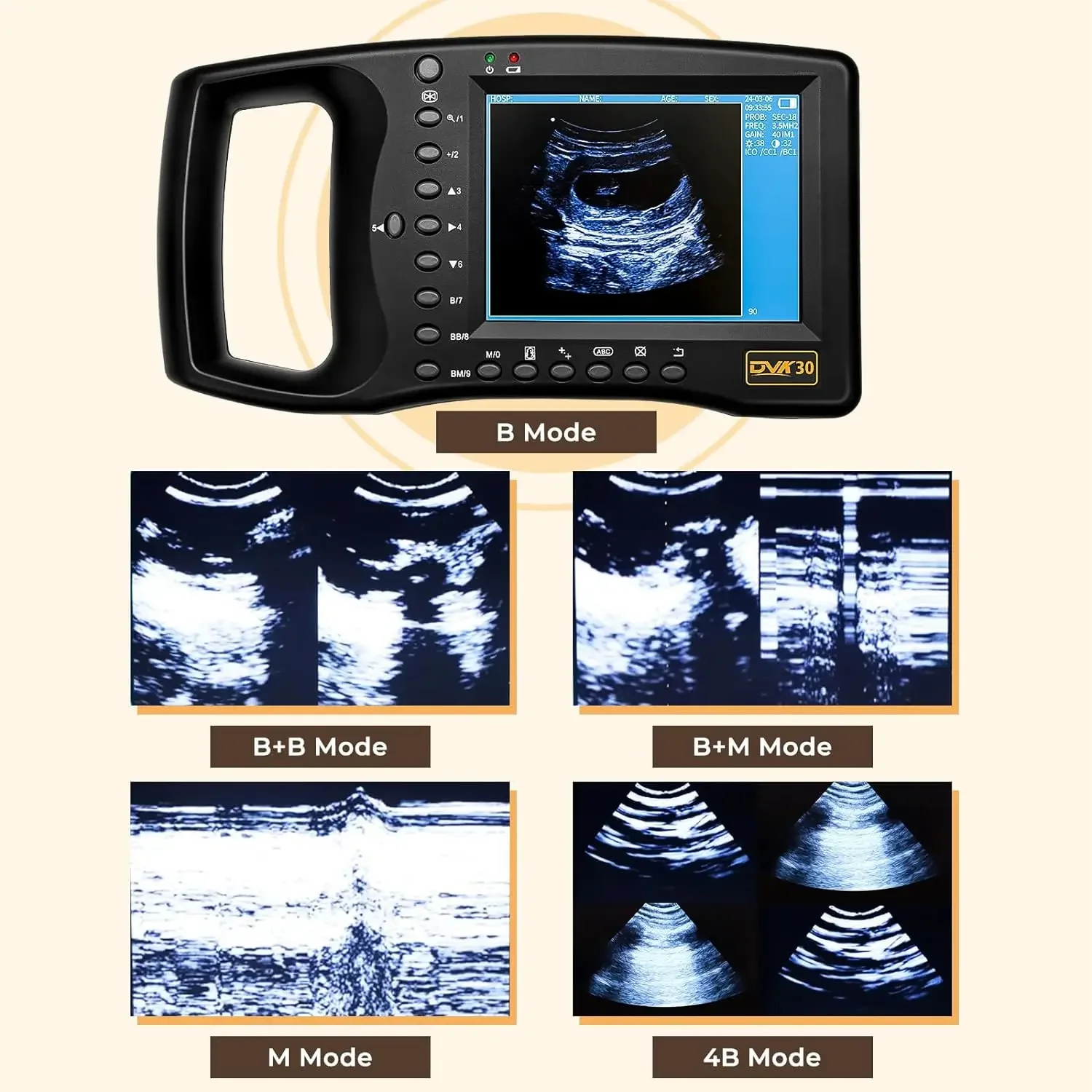 Portable Veterinary Ultrasound Scanner for Pregnancy Dog Sheep Pigs Vet Handheld Scanner with 3.5Mhz Mechanical Probe 5