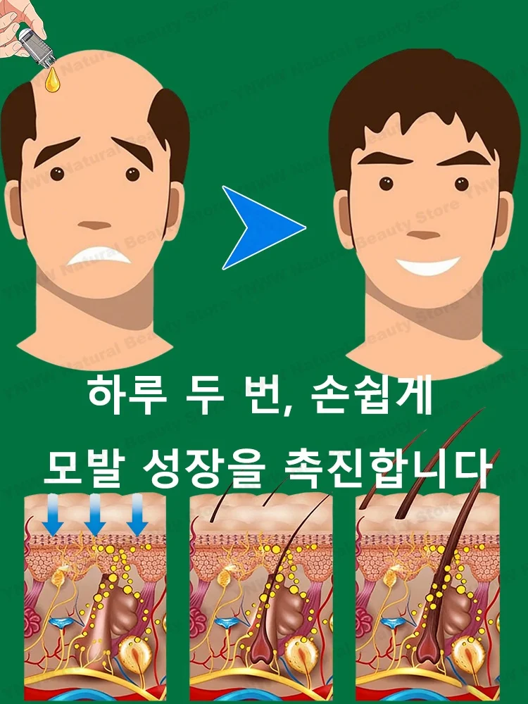 헤드 미니어 어플리케이터, 두피 어플리케이터, 모발 성장 솔루션, 볼 마사지 에센셜 오일, 빗 코팅