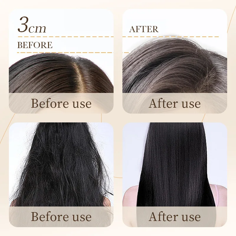 Shampoo alla Polpa di Riso 500ml, Rinfrescante, Controllo Oleosità, Nutriente, Volumizzante, Anti-Forfora, Anti-Prurito - immagine 5