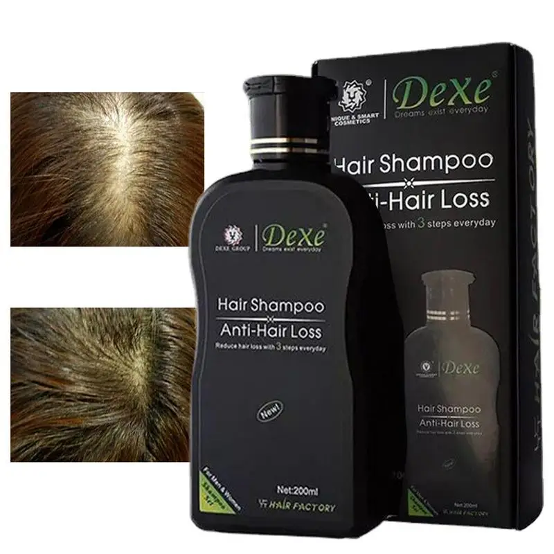 

Shampoo For Hair Loss Nourishing Natural Hair Thickening Shampoo 200ml Deep Cleansing Oil Control Routine Shampoo For Thinning