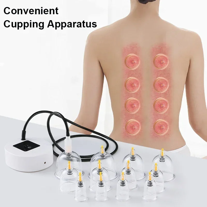 Electric Cupping Therapy Set Machine with Pump, Professional 12 Vacuum Suction Cups, Electric Universal Cupping Kit for Homeuse