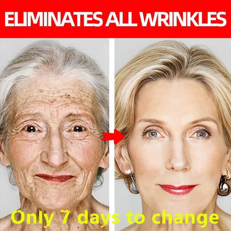 

Эффективная отбеливающая сыворотка, эссенция веснушек, Антивозрастная, обесцвечивающая пигментация, мелазма, осветляющая, красота, уход за кожей лица