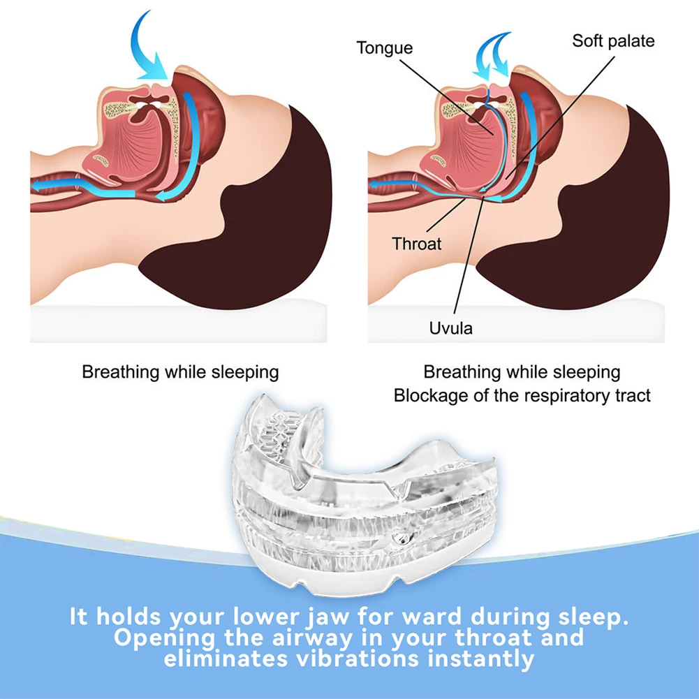 Anti Snoring Mouth Guard Improve Sleeping Adjustable Snoring Mouth Guard Anti-Apnea Teeth Bruxism Stop Snoring Device Mouthpiece 2