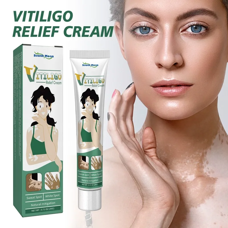 Effectively Remove Vitiligo Ointment Natural Repair Remove Ringworm White Spot Removal Skin Vitiligo Eliminate Skin Care 20g vitiligo ointment