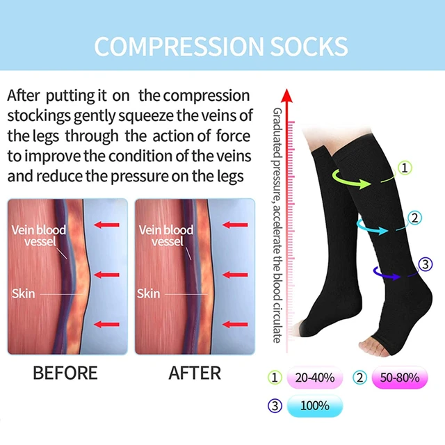 Compression Socks S-XXL Medical Prevent Varicose Veins Toeless Support Hose for Women Men 1 Pairs 2