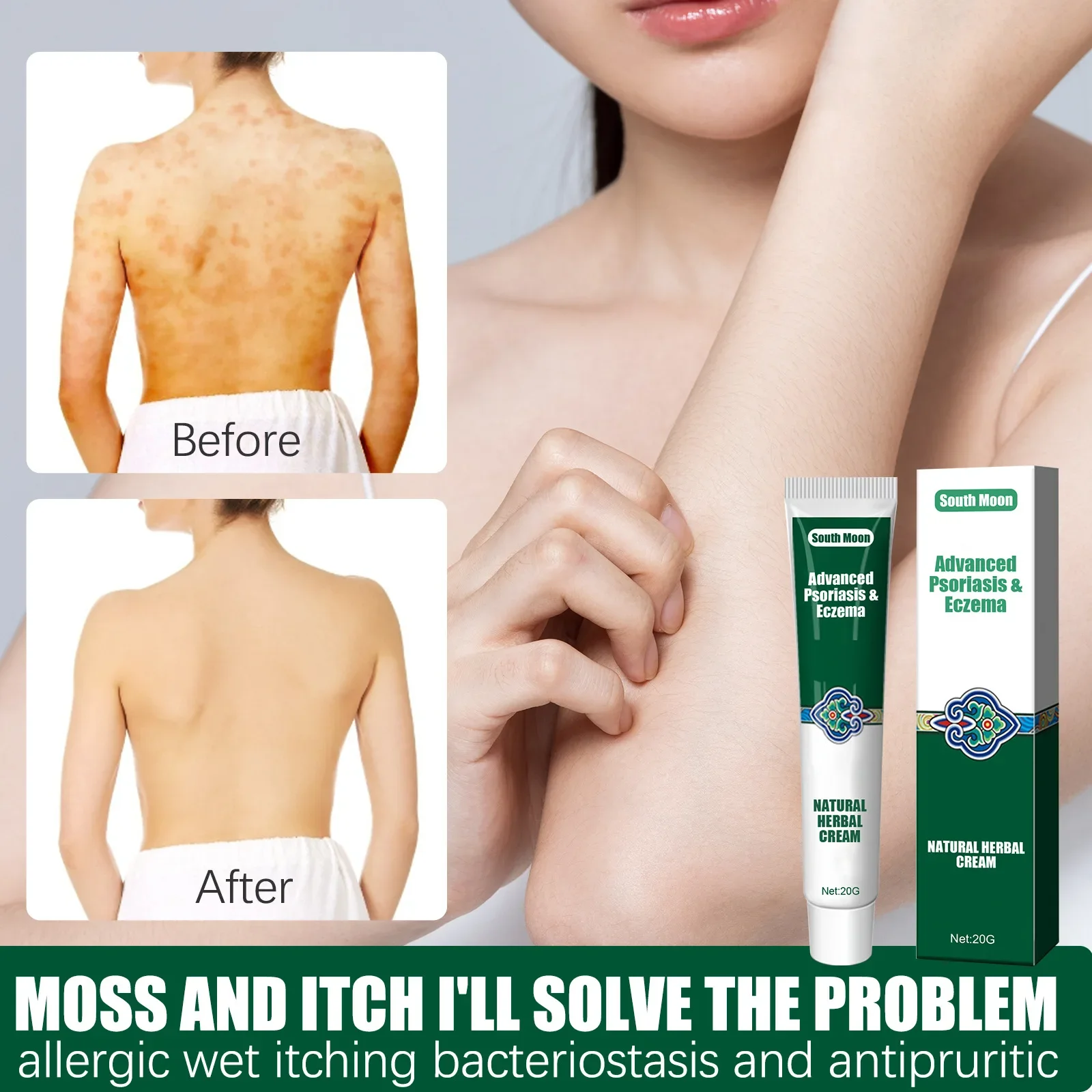 South Moon Psoriasis Ointment Eczema Herbal Cream Treatment Urticaria Desquamation Antibacterial Anti-Itching Health Skin Care