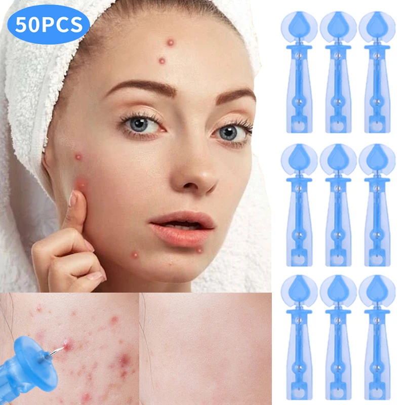 Disposable Blackhead Remover Acne Needle 50PCS/Pack Mini Safe Hygienic Acne Needles Fat Grain Beauty Skin Care Acne Remover Tool one pack of standard needle for asphalt penetration tester 3 needles