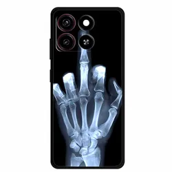 Black Silicone Soft Back Cover Case - Versatile and Protective Phone Shell for ZTE Blade A35 (B06.CH.19)