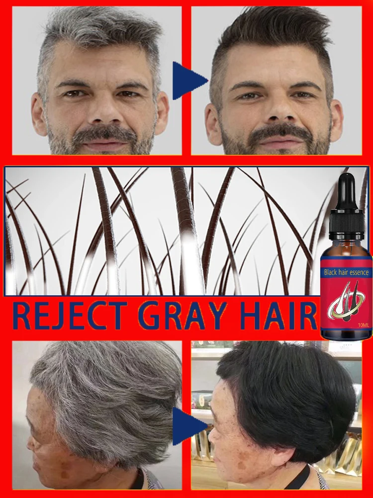 White hair killer remove gray hair restore natural color 7 days hair coloring product