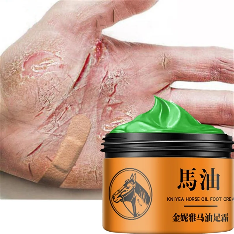 1pcs Horse Oil Hand And Foot Repair Cream Skin Moisturizing Foot Skin Care