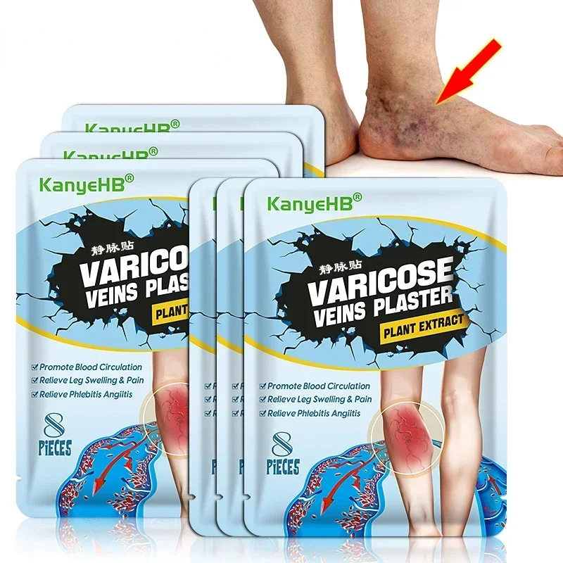 Varicose Veins Patch 6/8pcs Vascular Veins Remover Spider Legs Treatment Chinese Medical Plaster Angiitis Stickers Skin Care varicose veins patch