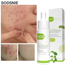 

Acne Serum Moisturizing Remove Pimples Blackheads Oil Control Brighten Centella Nourish Repair Rough Shrink Pores Skin Care 30ml