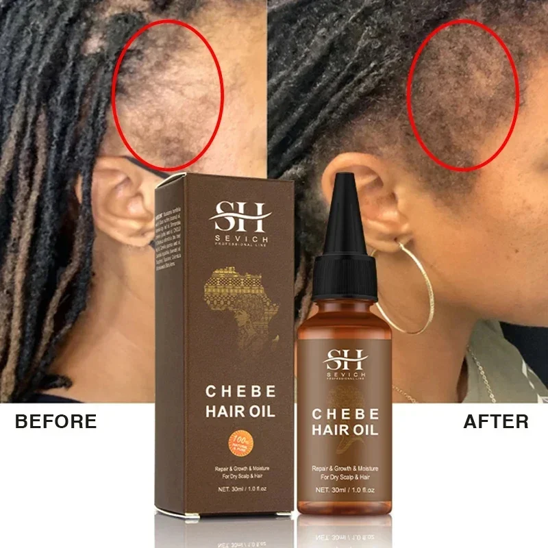 

Africa Fast Hair Growth Oil Chebe Oil Traction Alopecia Treatment Products Repair Damage Anti-Hair Loss Hair Care Product Sevich