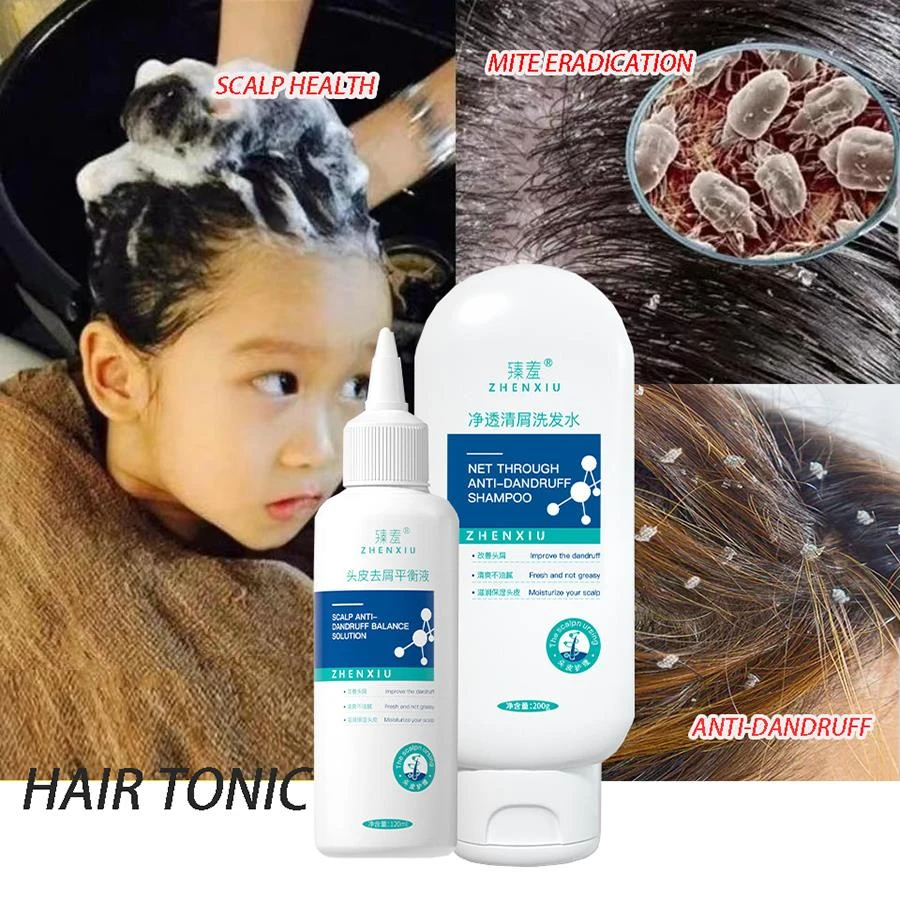 

Lice Mites Remover Liquid Shampoo Anti Dandruff Shampoo Anti Hair Loss Treatment Oil Control Refreshing Scalp Follicle