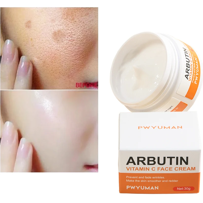 

Whitening Freckles Cream Dark Spots Removal Vitamin C Face Cream Remove Melasma Dark Spot Correcting Brightening Facial Skin