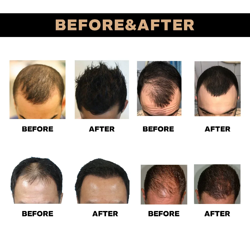 East Moon Polygonum multiflorum hair care solution is strong, firm, dense, anti shedding, moisturizing, and hair care solution
