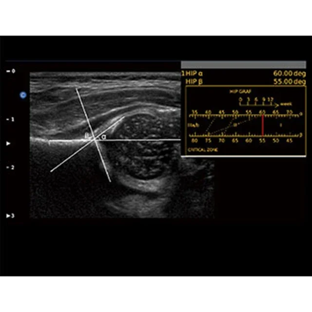 Рисунок 6 - CHISON Ebit 30, медицинские ультразвуковые инструменты