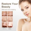 Electric Blackhead Meter to Remove Blackheads Acne Clean Pores Home Beauty 4