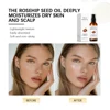Organic Rosehip Oil Rose Hips Face Oils 30ml Fast-Absorbing For Anti-aging Scar Treatment Skin Care Moisturizer Face Oil 4