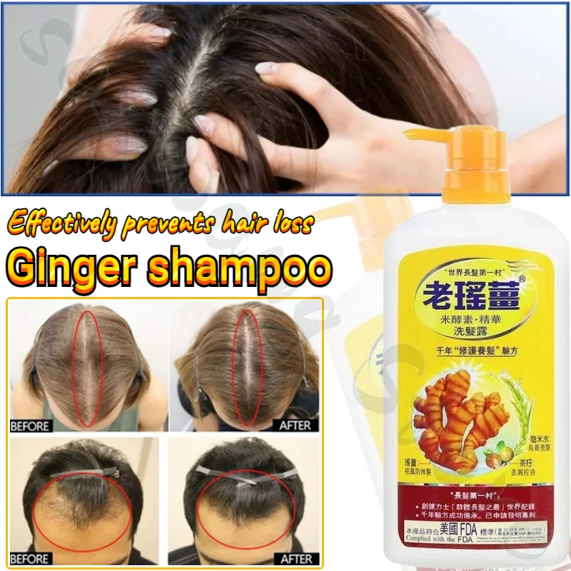 Ginger Shampoo Improves Hair Quality, Removes Dandruff, Controls Oil, Prevents Hair Loss, Improves Scalp and Nourishes Hair