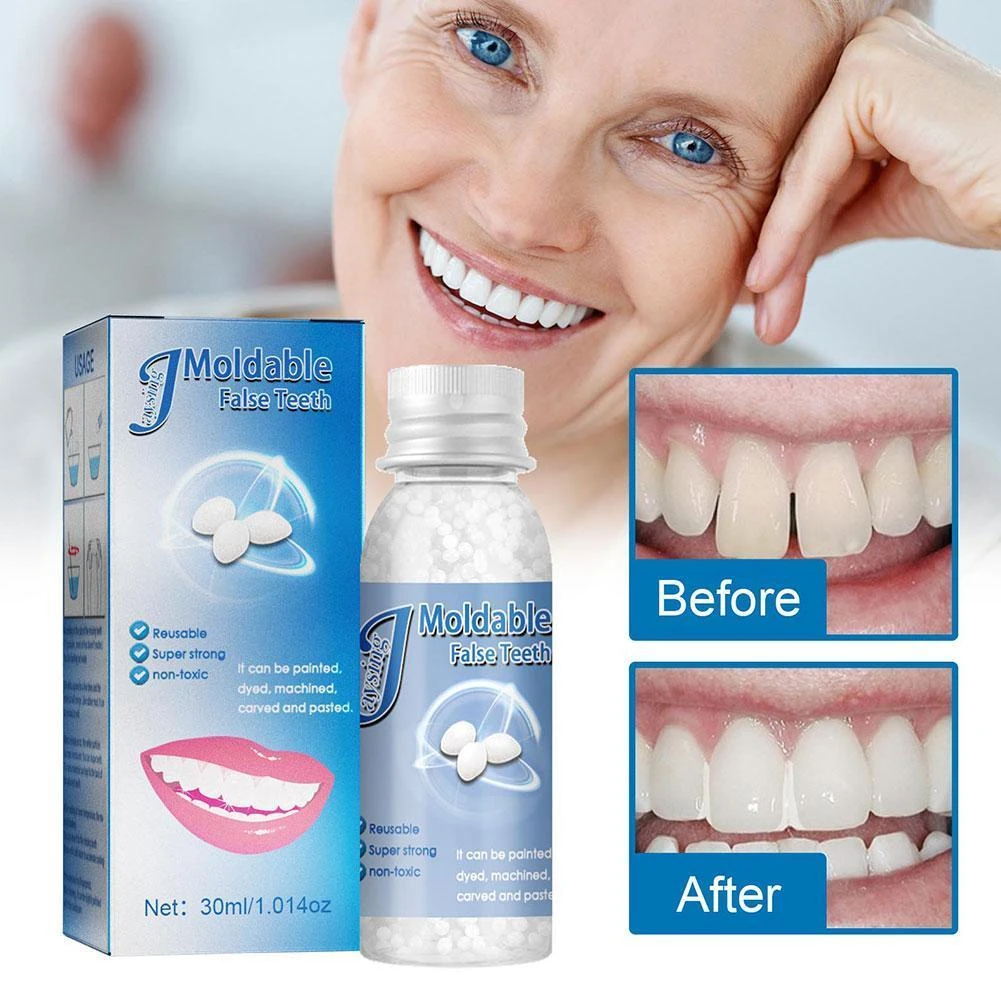 30G Prothese Lijm Tand Kit Tanden En Hiaten Falseteeth Lijm Adhesive Tijdelijke Stickers 2022| | - AliExpress