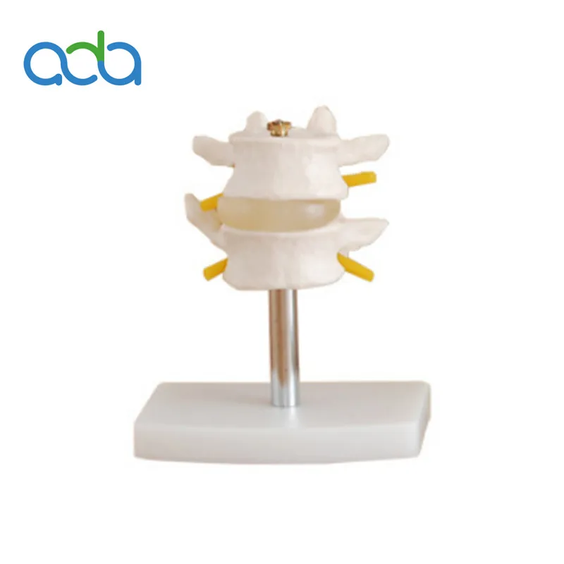 

BIX-A1015 Normal Lumbar Vertebrae combination (Two section)