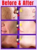 Large pores problem 3