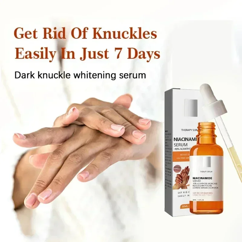 Fast whitening serum Elbows Armpit Beaching Serum Private Part Skin Removal Dark Knuckles Strong Whitening Serum