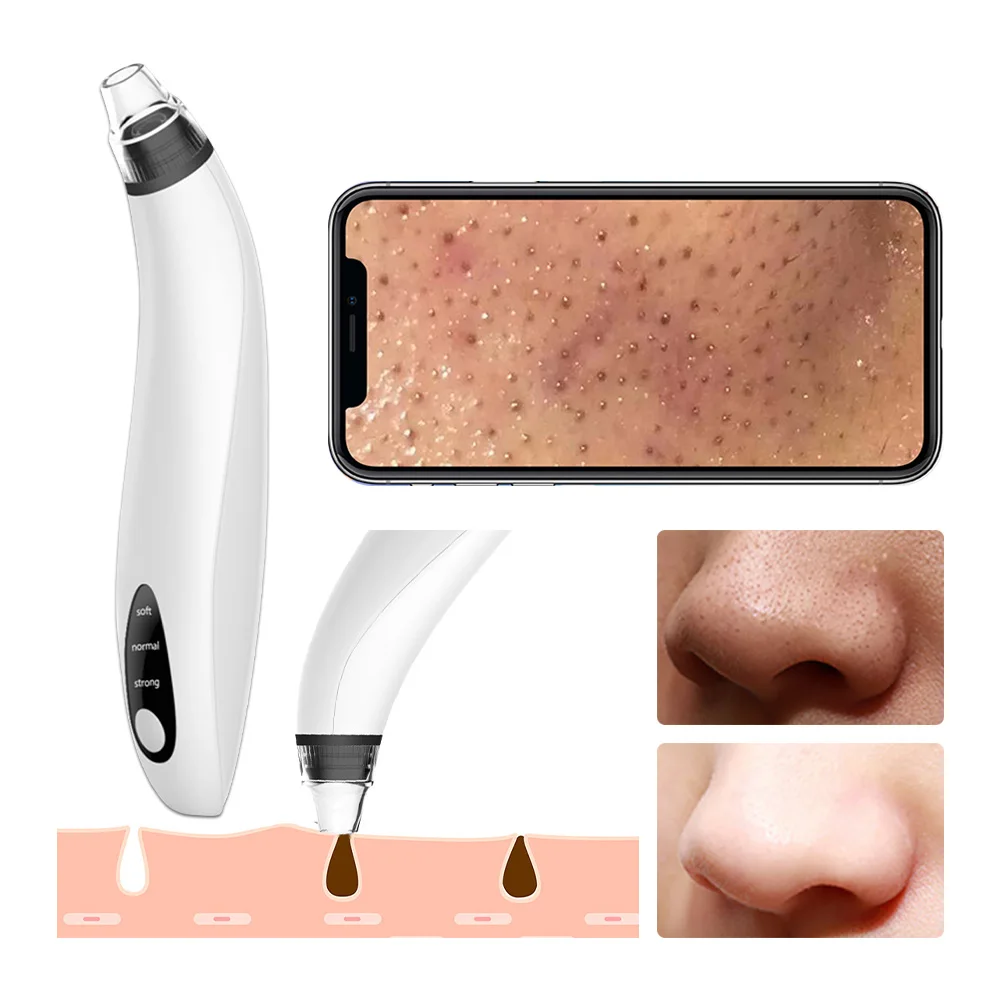 

Electric Visual Blackhead Remover Device USB Rechargeable Pore Vacuum Cleaner Black Spots Acne Pimple Extractor Removal Tool Set