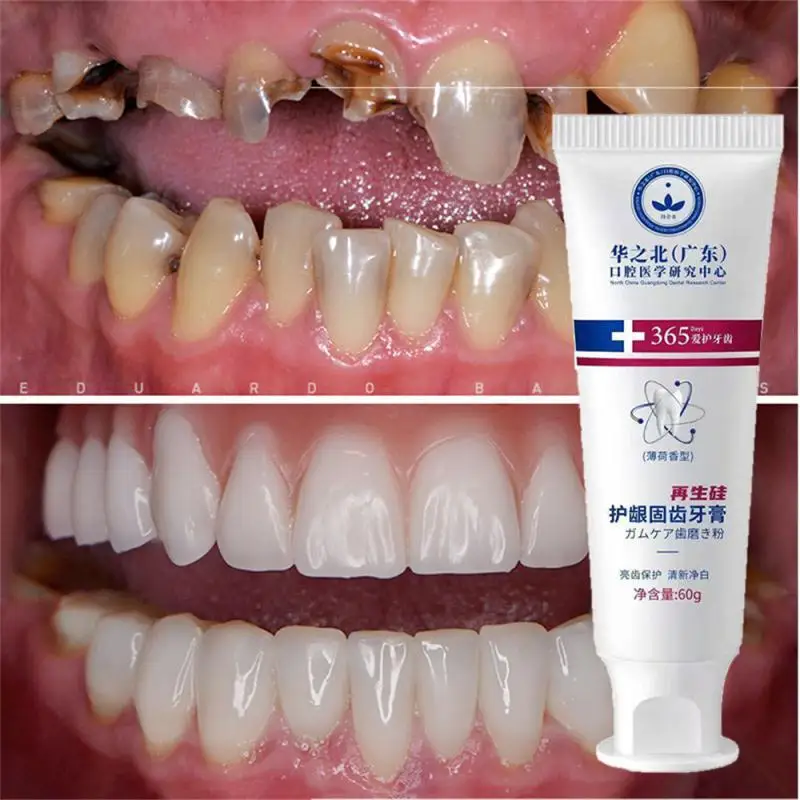 

Teeth Whitening Toothpaste Quick Repair of Cavities Fresh Breath Removal of Plaque Repair Teeth Care Product Wholesale