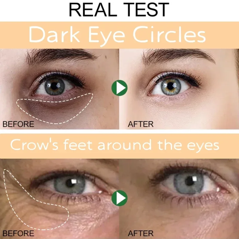 Instant Eye Bag Removal Cream Collagen Removal Wrinkles Lifting Fade Fine Lines Moisturizing Brightening Anti Puffiness Eye Care eye cream