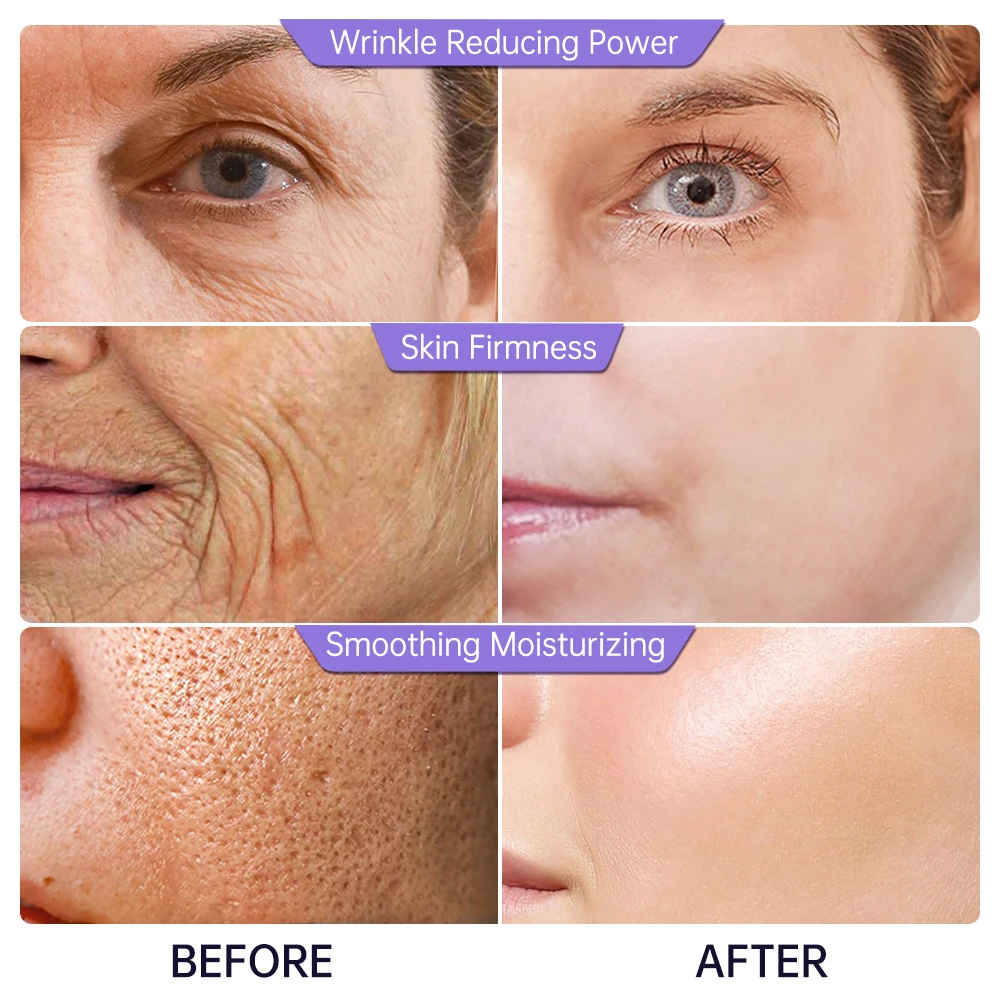 Collagen Face Serum Wrinkle Removal Hyaluronic Acid Anti Aging Fine Lines Lifting Niacinamide Brighten Serum Skin Care JoyPretty 4